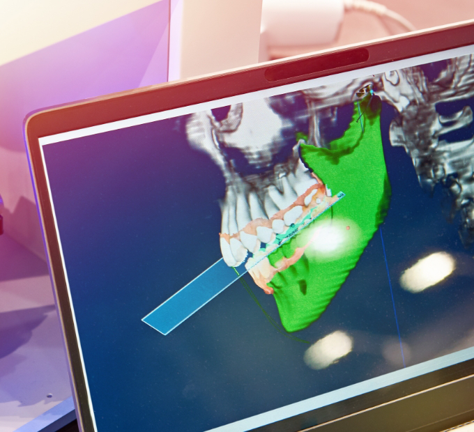 Side profile X ray of a patients jaws and teeth